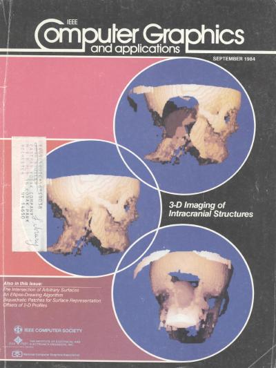 1984, no. 9: 3D Imaging of Intracranial Structures